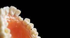 Dentist Dentistry Orthodontics  - huertacs / Pixabay